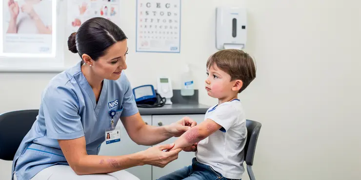 Is eczema contagious?